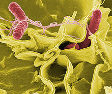 Salmonella - salmonelóza Salmonella - salmonelóza