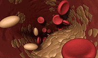 cholesterol